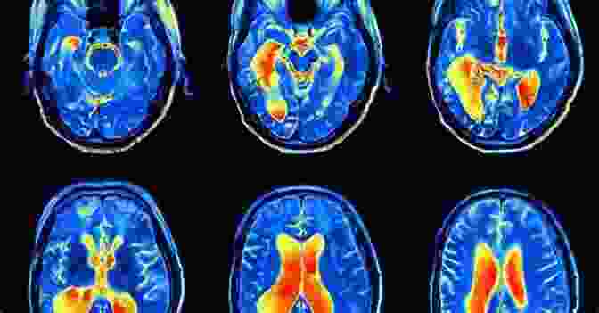 Brain Scanning Image Highlighting Areas Involved In Self Control Self Discipline Made Easy: Achieve Your Goals Learn How Self Control Works And Beat Procrastination