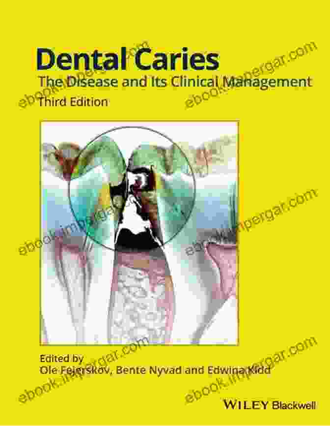 Tests Of Dental Caries Activity And Susceptibility Review Book Cover Tests Of Dental Caries Activity And Susceptibility A Review