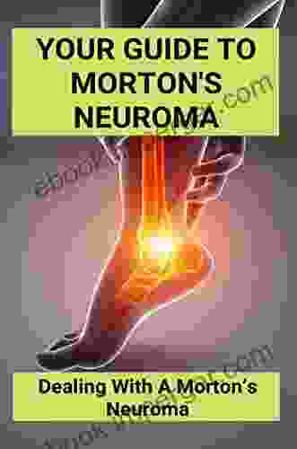 Morton S Neuroma: What Is It And How To Stop The Pain